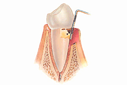 Periodontia